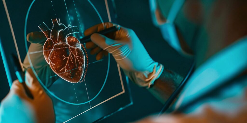 Rotablation Angioplasty