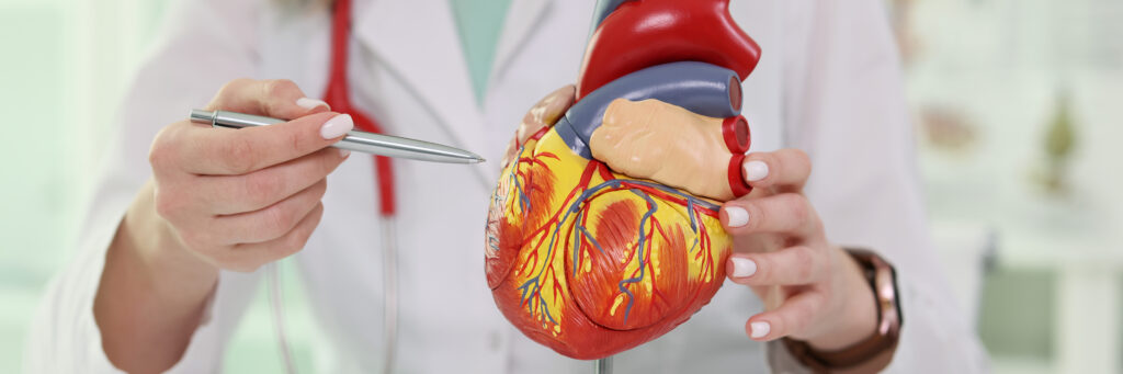 angioplasty