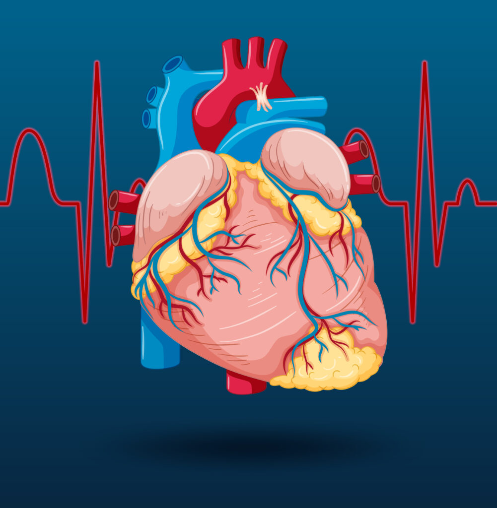 Cardiac Angioplasty