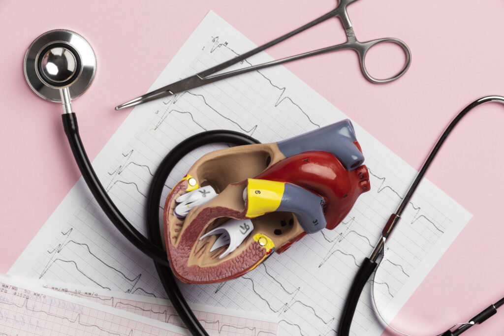 Rotablation Angioplasty