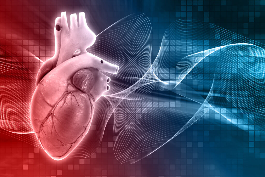 Coronary Artery Disease